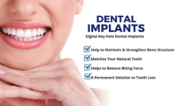 Dental implants.png